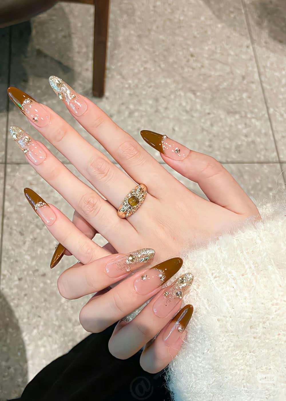 Nail kim tuyến sáng lấp.