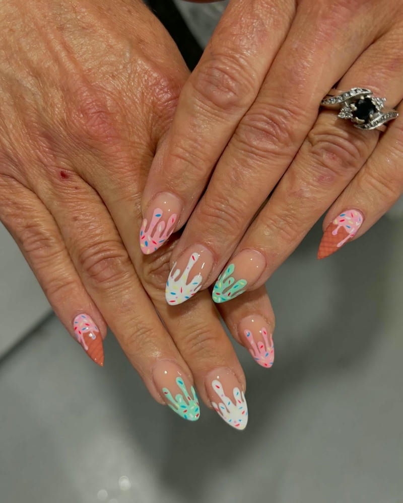 nail kem chảy đầu móng